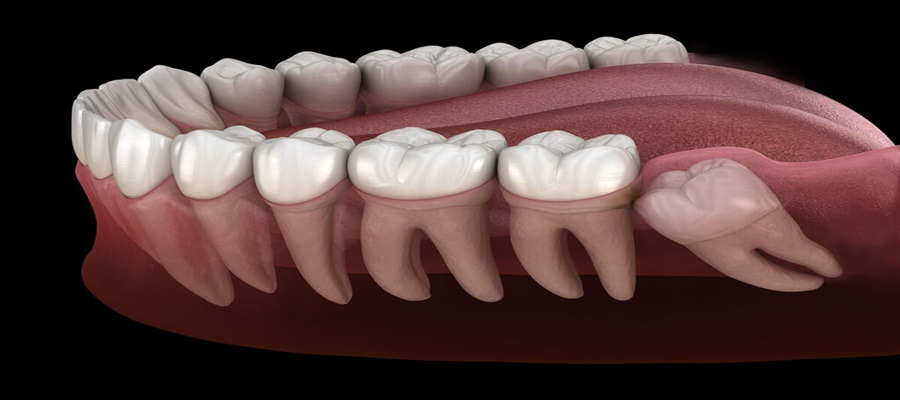 20lik-diş900x400