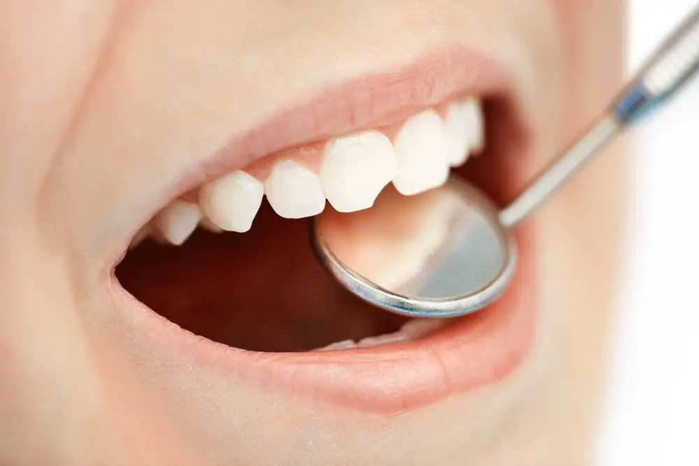 tooth-stone-cleaning-in-turkey